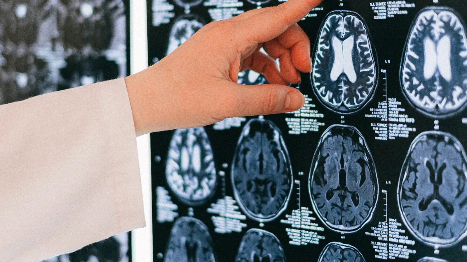 Cómo anonimizar historiales clínicos para investigación médica según el RGPD